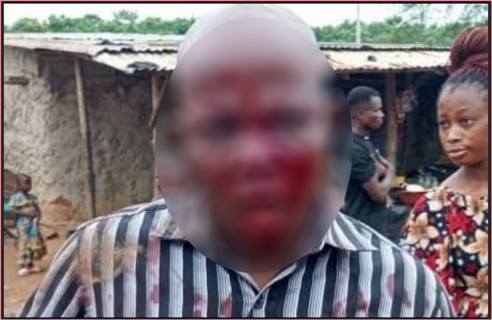 Côte d'Ivoire : Tiassalé, un directeur d'ecole violemment agressé à l'aide d'une machette