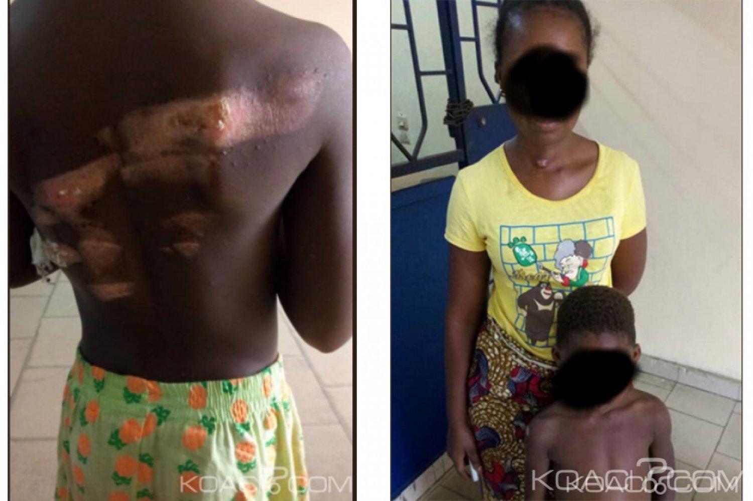 Côte d'Ivoire : La tante met un couteau au feu et l'appose sur sa nièce de 7 ans pour n'avoir accompli les tà¢ches ménagères
