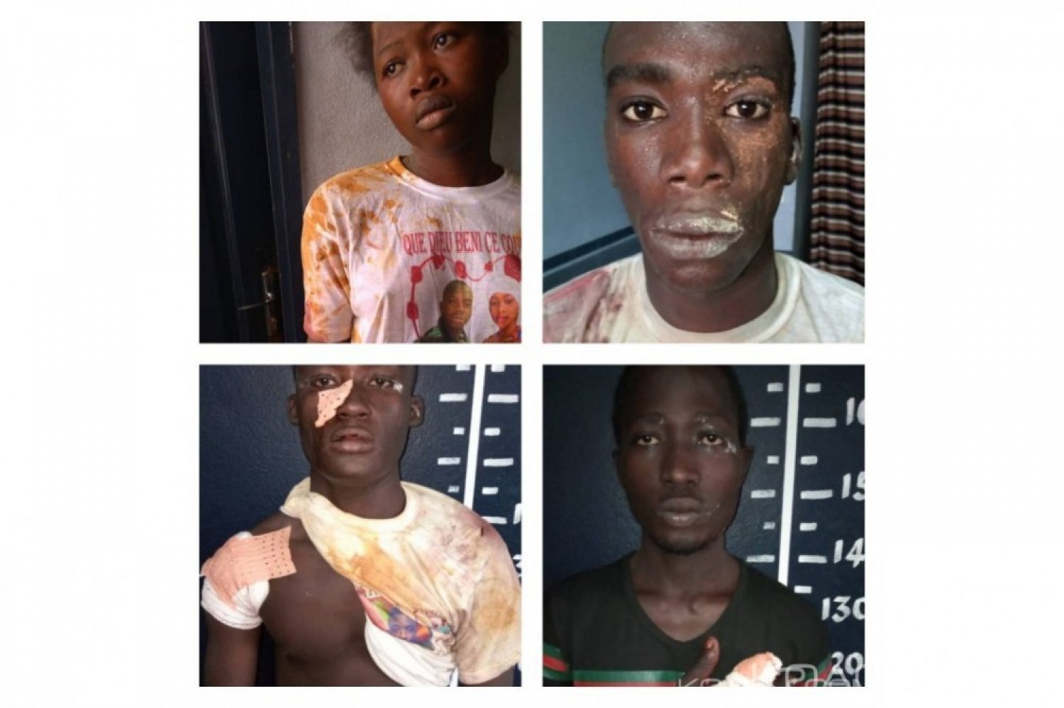 Côte d'Ivoire: Bagarre de microbes à  Abobo, 03 meneurs et 39 suspects interpellés