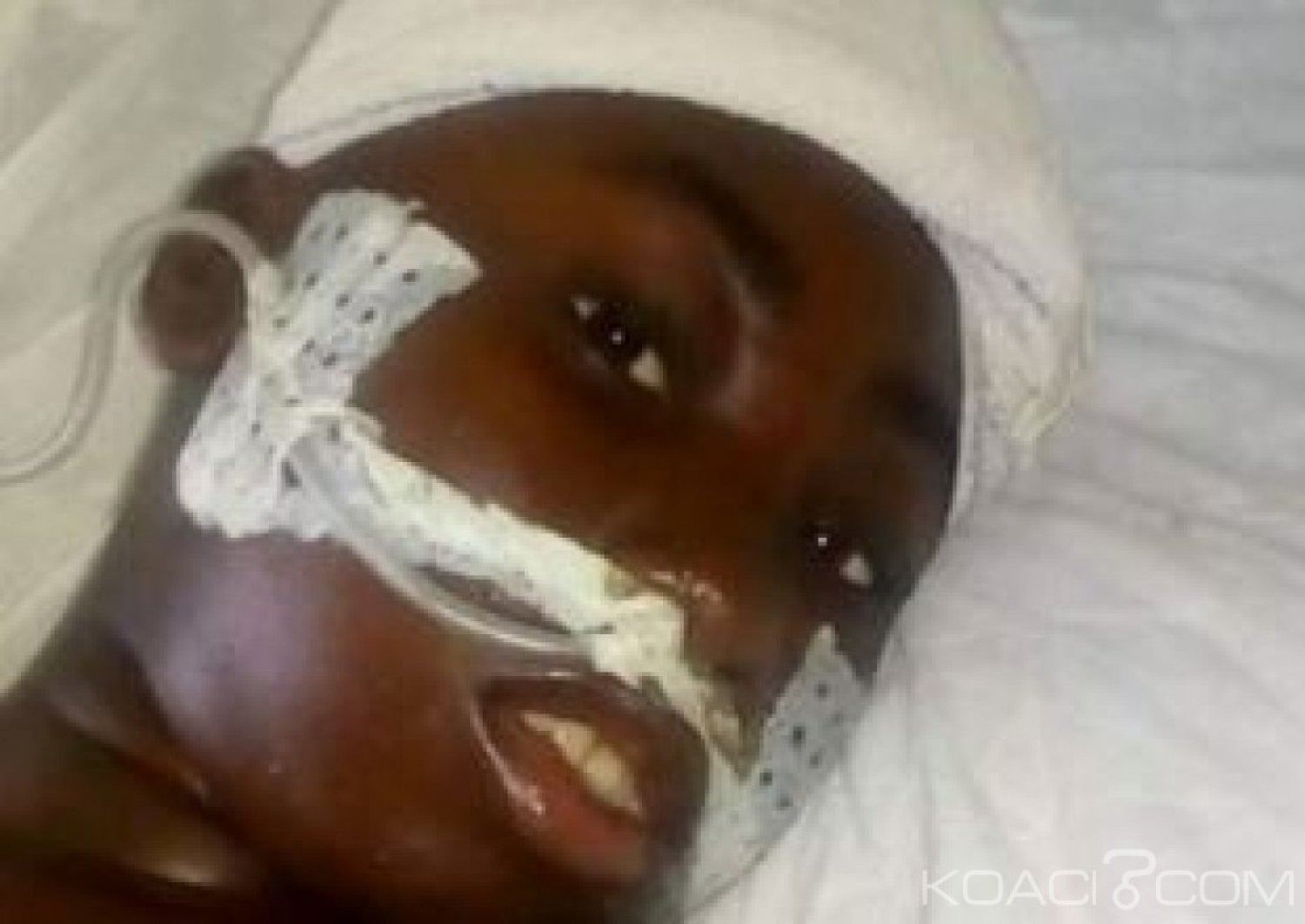 Côte d'Ivoire : Drame à  Issia, elle sort d'un coma d'un mois après avoir vu sa tête explosée par un brouteur