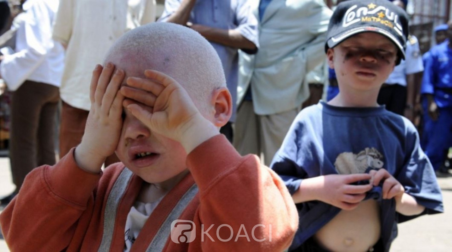 Burundi: Le corps d'un albinos de15 ans retrouvé démembré à la frontière avec la RDC