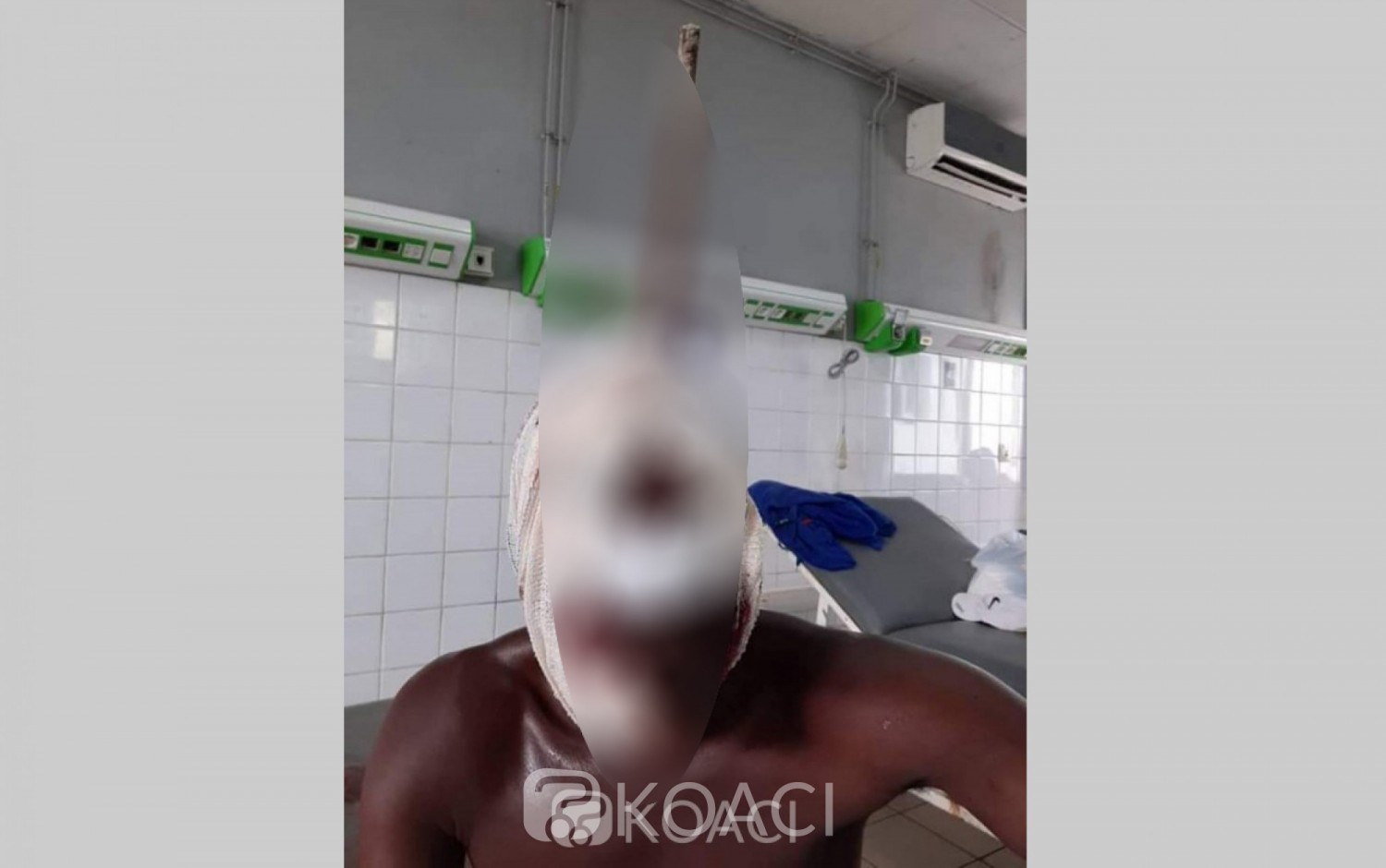 Côte d'Ivoire: En plein boulot, une barre de fer transperce la tête d'un ouvrier