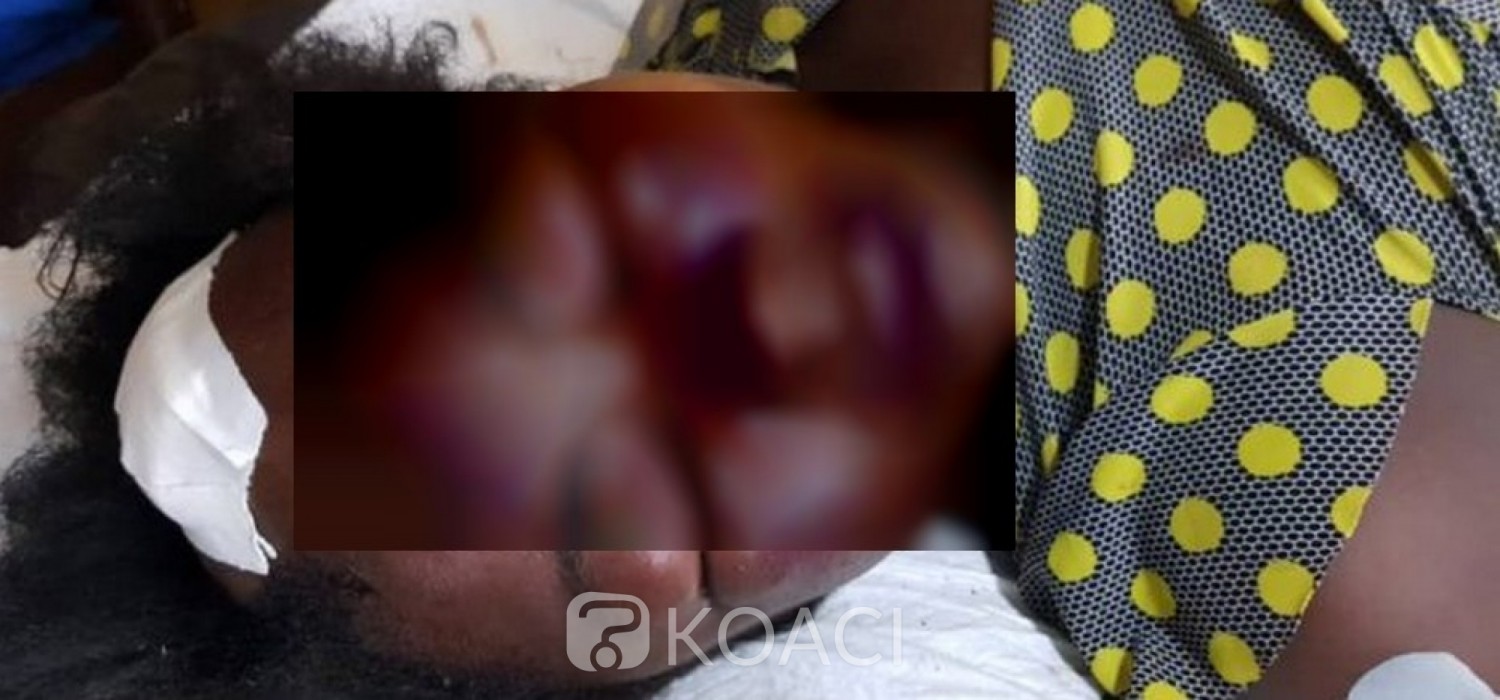 Ghana: Il surprend sa femme en flagrant délit de « tricherie », l'envoie en coma et se fait agresser