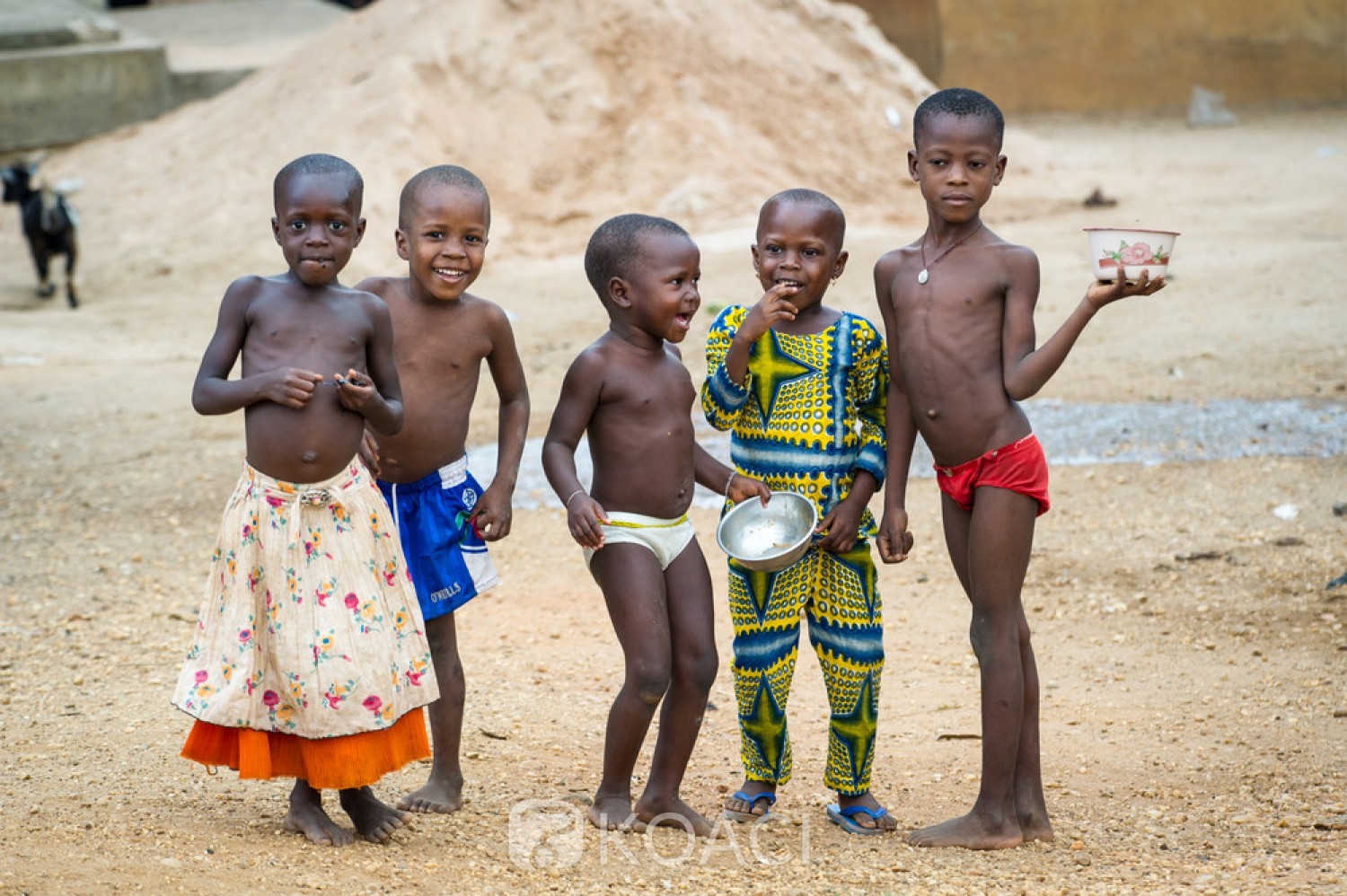 Burkina Faso : 535,500 enfants de moins de 5 ans souffrent de malnutrition aiguë