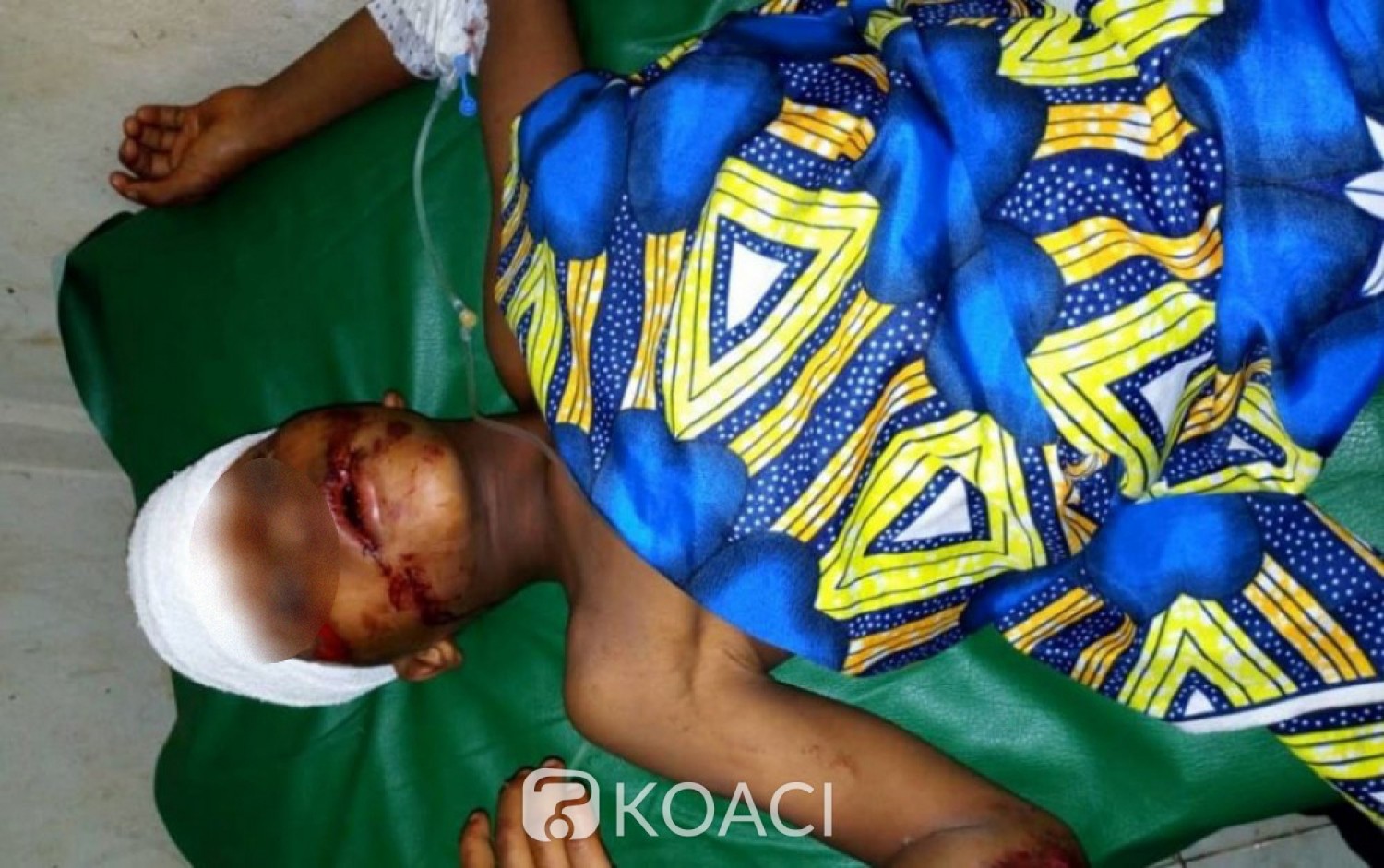 Côte d'Ivoire : Bouaké, renversé puis abandonné par le véhicule d'un ministère, un enfant en sang récupéré par les siens