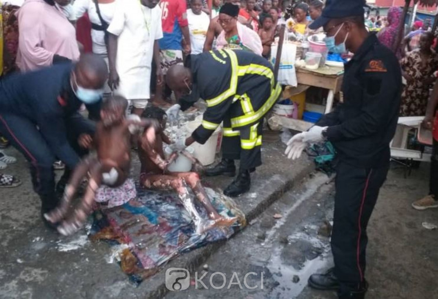 Côte d'Ivoire : Adjamé, des brûlés dans l'explosion d'une  bouteille lors d'une fête de réjouissance