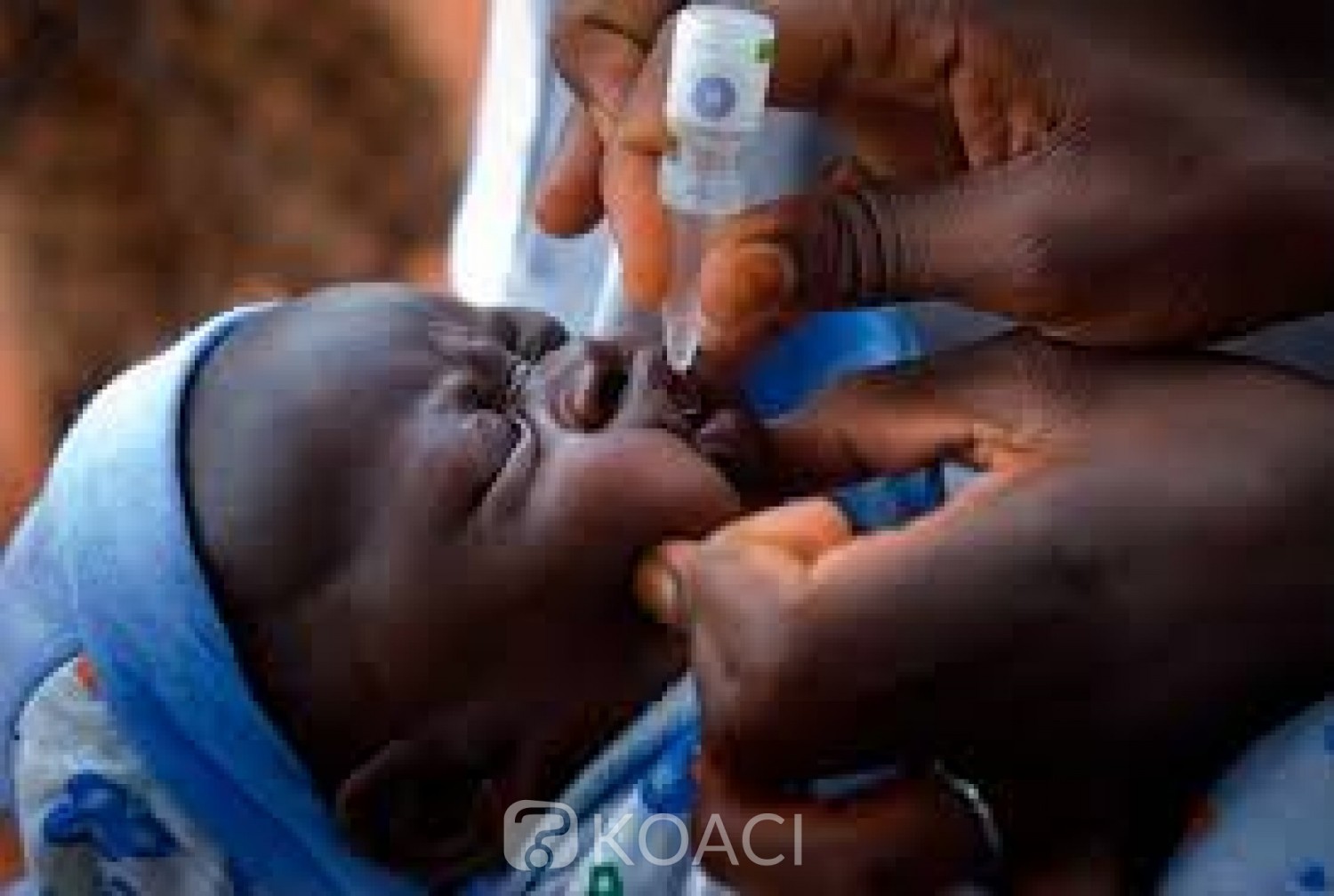 Burkina Faso : Lancement d'une campagne de vaccination contre la polio après la détection de cas