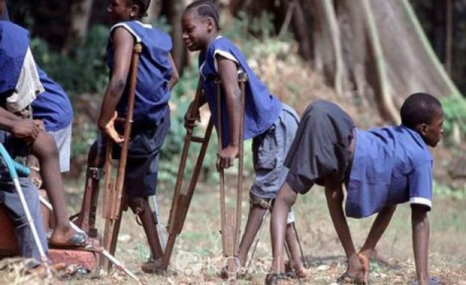 Cameroun : Annoncée éradiquée, l'épidémie de poliomyélite fait son retour