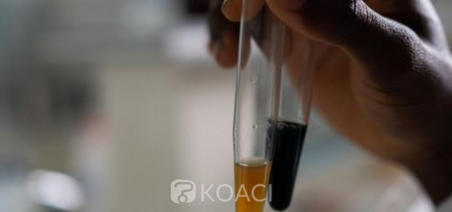 Côte d'Ivoire : Un Biomédecin chercheur annonce la mis sur pied d'une molécule qui guérit la COVID-19, connue des autorités du pays qui reste sans promotion
