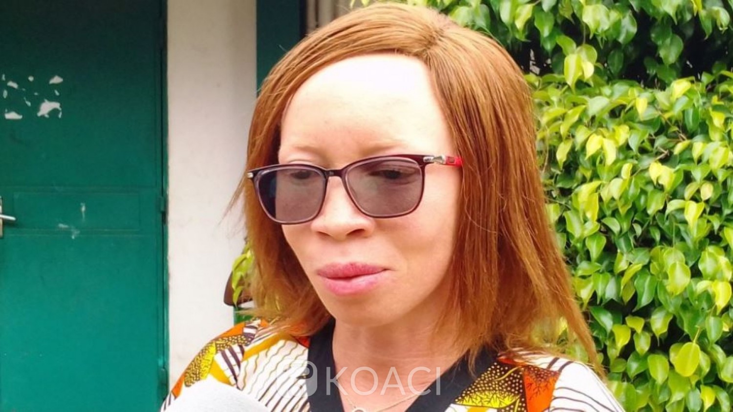 Côte d'Ivoire : Sollicitant de l'aide pour les albinos, leur présidente: « Nous sommes victimes d'agressions physiques et sexuelles à cause des préjugés »