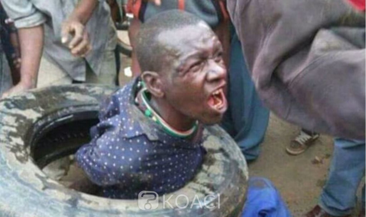 Cameroun : Vindicte populaire et lynchages, quels messages les masses envoient aux autorités ?