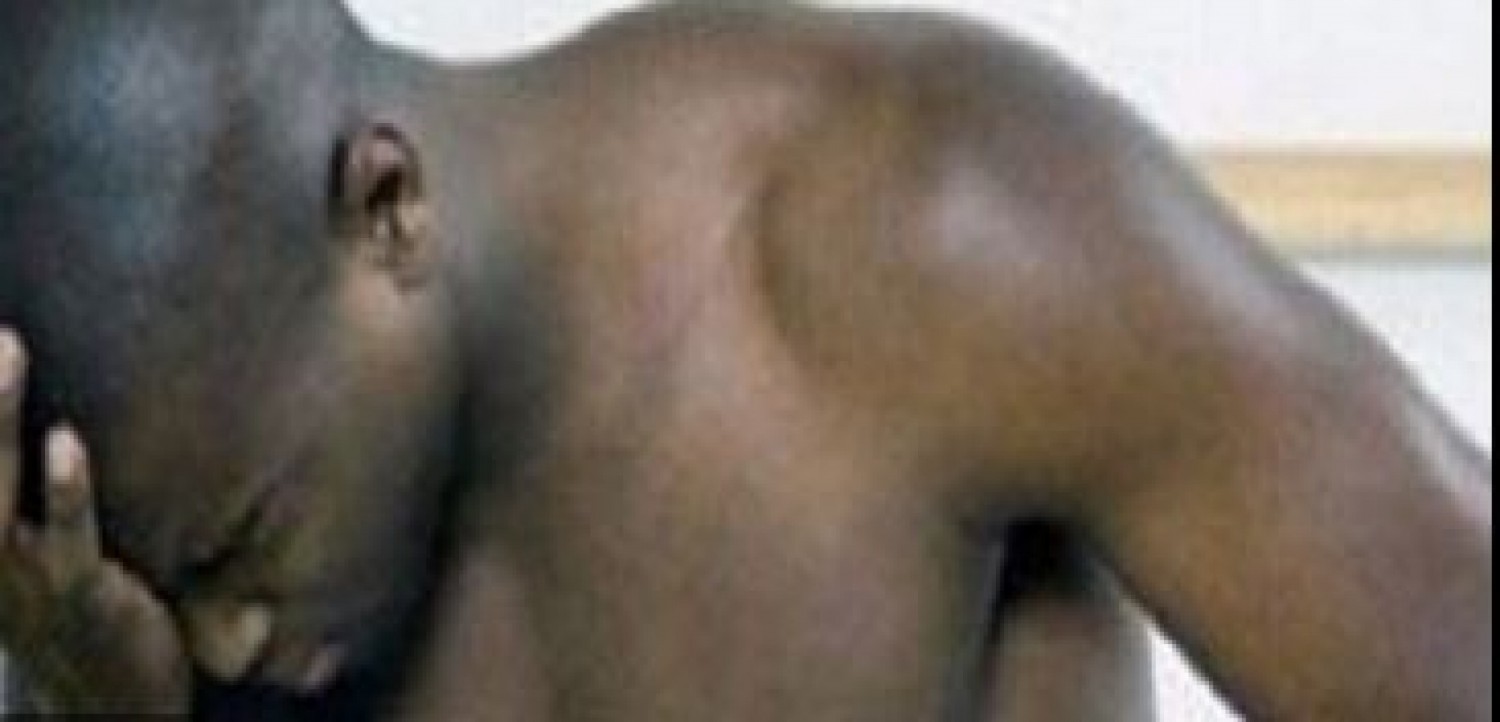 Côte d'Ivoire : Soupçonnant son oncle d'être à la base de sa faiblesse sexuelle, il l'abat et tente de se suicider