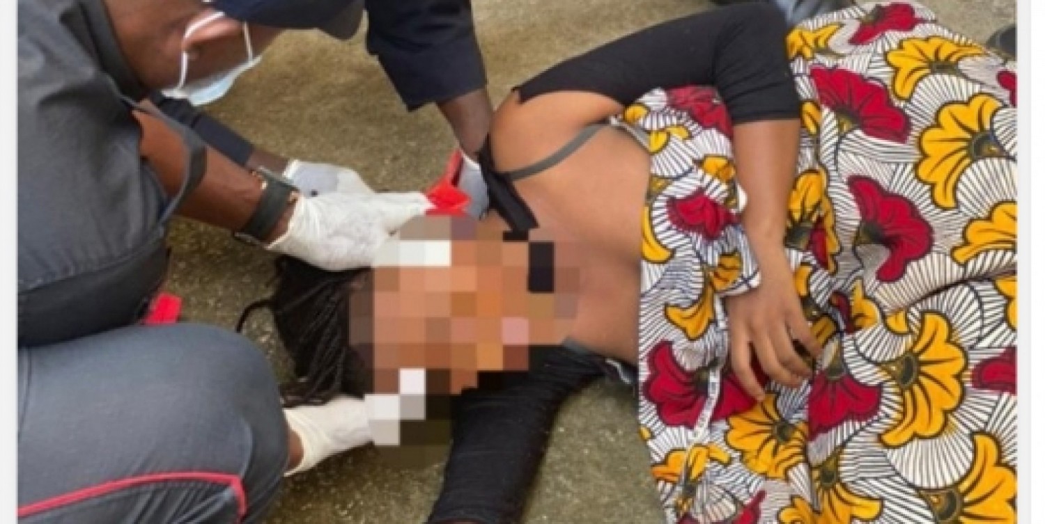 Côte d'Ivoire : Cocody,  une jeune fille fait une chute depuis le 4eme niveau d'un immeuble, fractures aux deux membres inférieurs