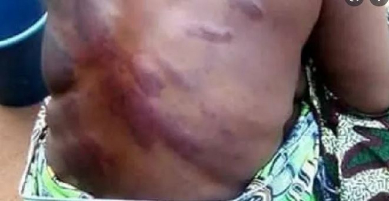 Côte d'Ivoire :  Abobo, Adou-Richard annonce la poursuite des enquêtes pour retrouver l'auteur de la bastonnade de l'institutrice enceinte de 6 mois en fuite