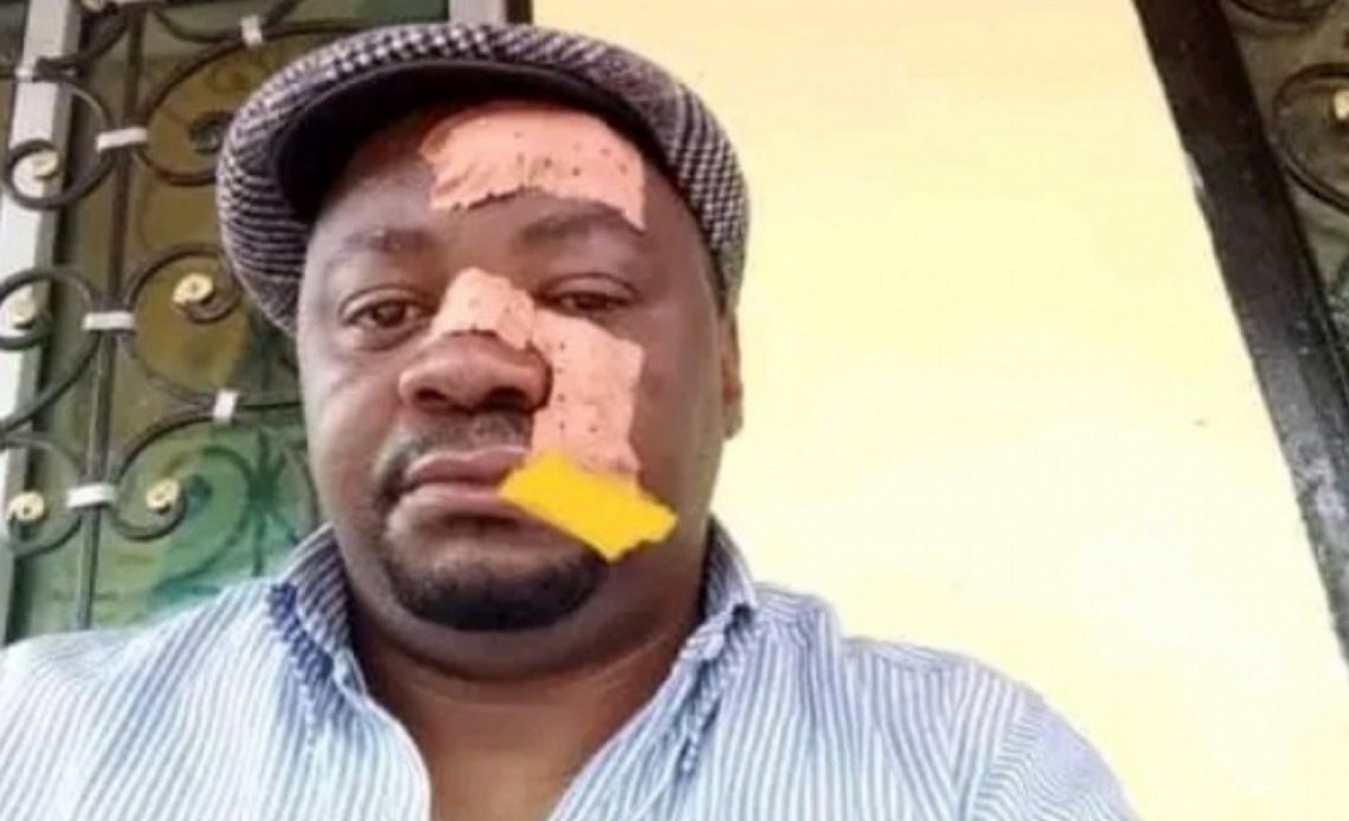 Cameroun : Bagarre sanglante au Rdpc, un maire blesse grièvement un député