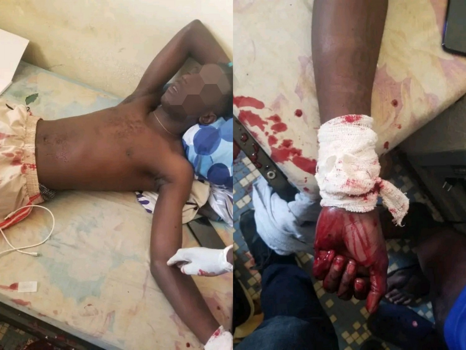 Côte d'Ivoire : Bouaké, un étudiant de l'UAO tente de se suicider en coupant ses veines