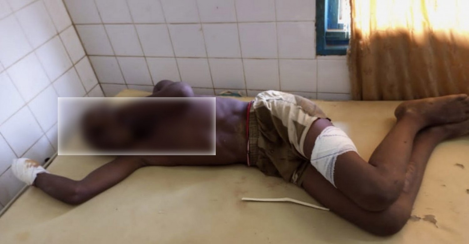 Côte d'Ivoire : Daloa, des individus font irruption dans un salon de coiffure et amputent le poignet d'un élève