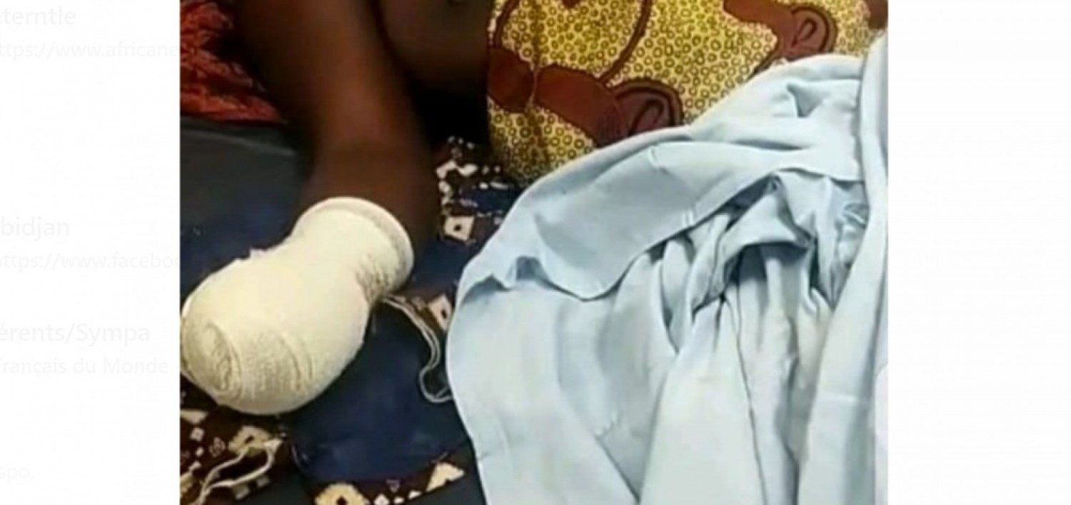 Côte d'Ivoire :  Affery, un homme cocufié sectionne les deux mains de sa compagne et tire sur son « rival » dans des funérailles