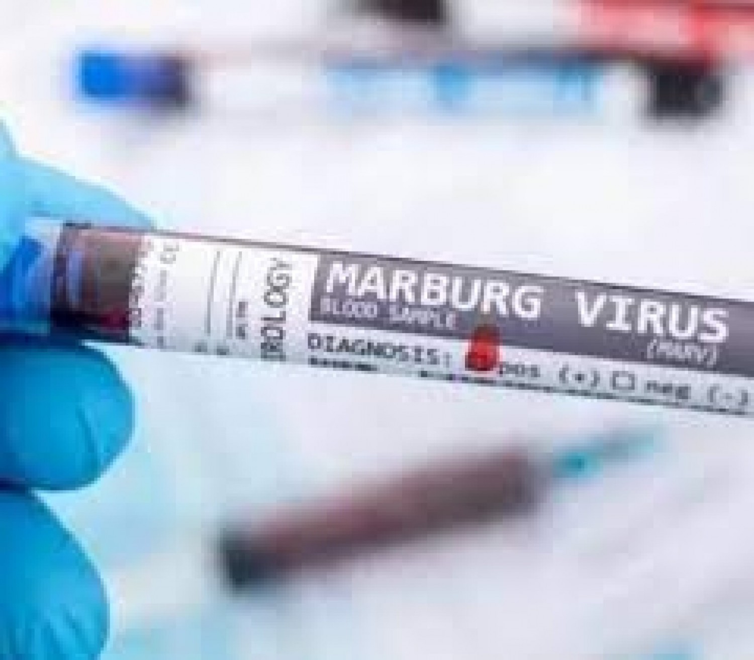 Tanzanie : La mystérieuse maladie qui a fait cinq morts provient d'un virus «cousin d'Ebola»