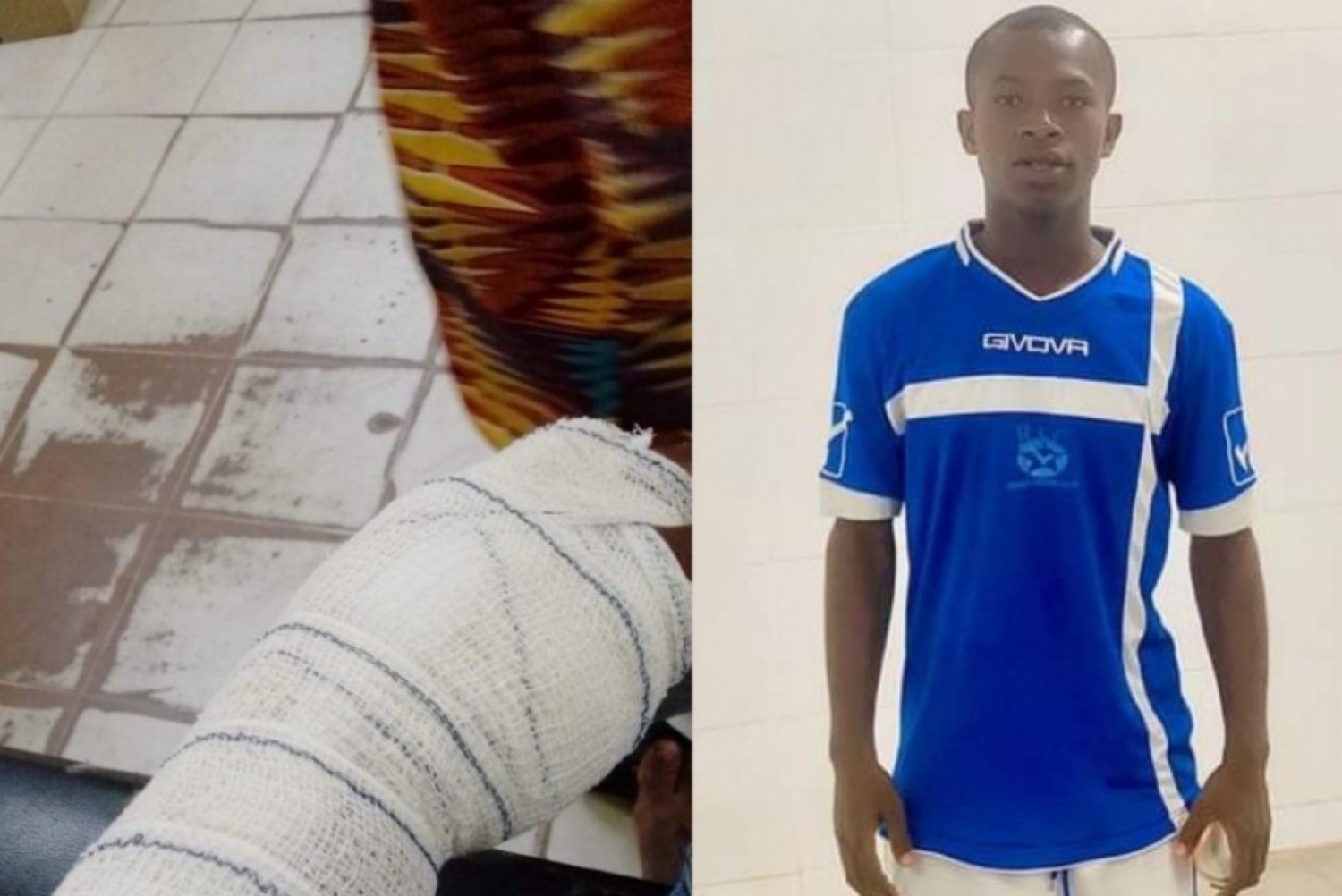 Côte d'Ivoire : Bouaké, un footballeur violemment agressé par des « jeunes » armés