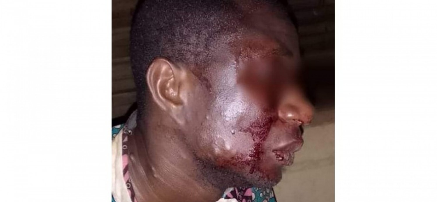 Côte d'Ivoire : Niakara, des enseignants de Kafiné battus par des jeunes du village aux ordres d'un cadre arrêté par la gendarmerie, un instituteur blessé gravement