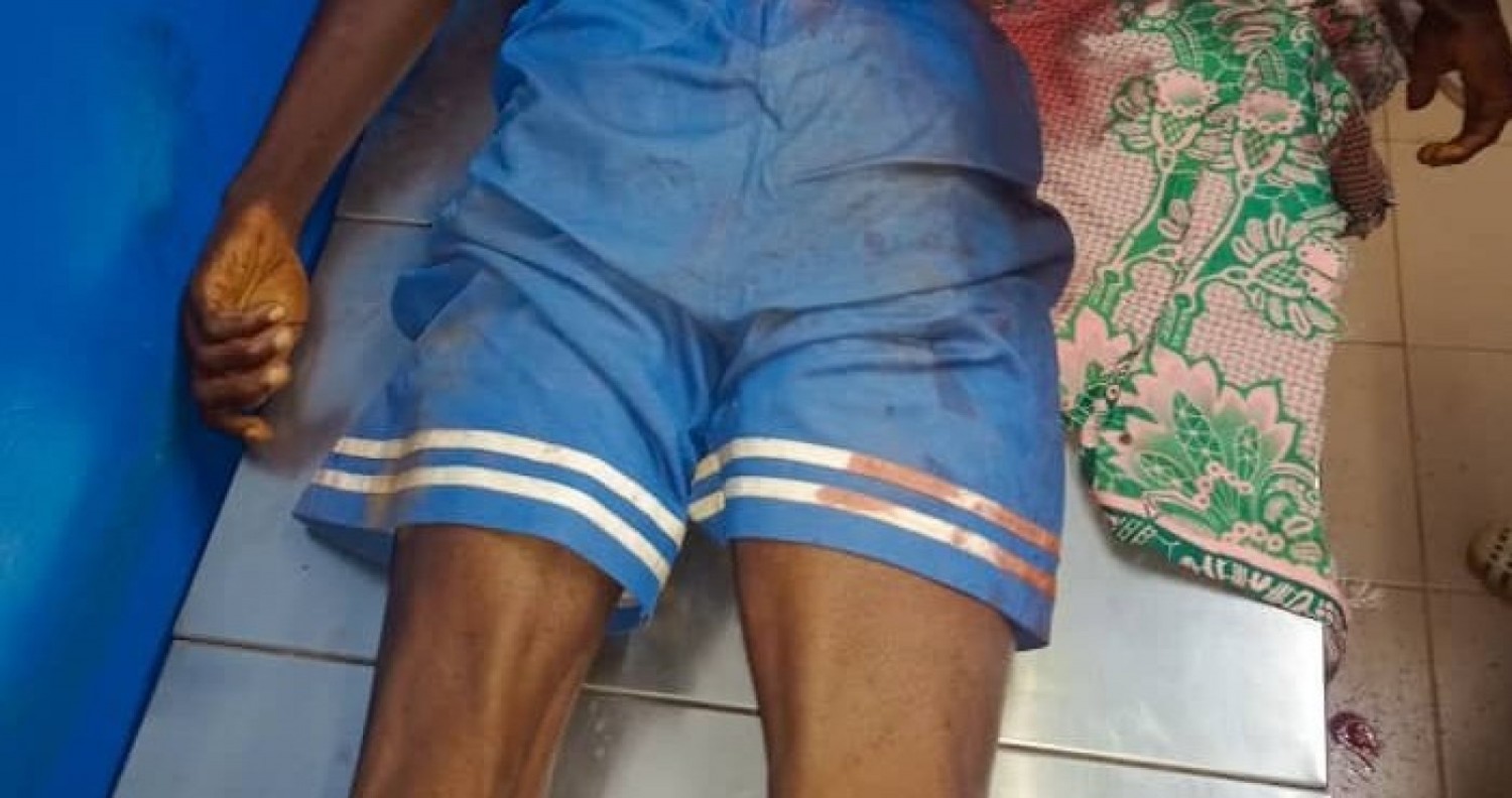 Côte d'Ivoire : Accusant son proche d'avoir tué sa mère  en sorcellerie, il le taillade à mort