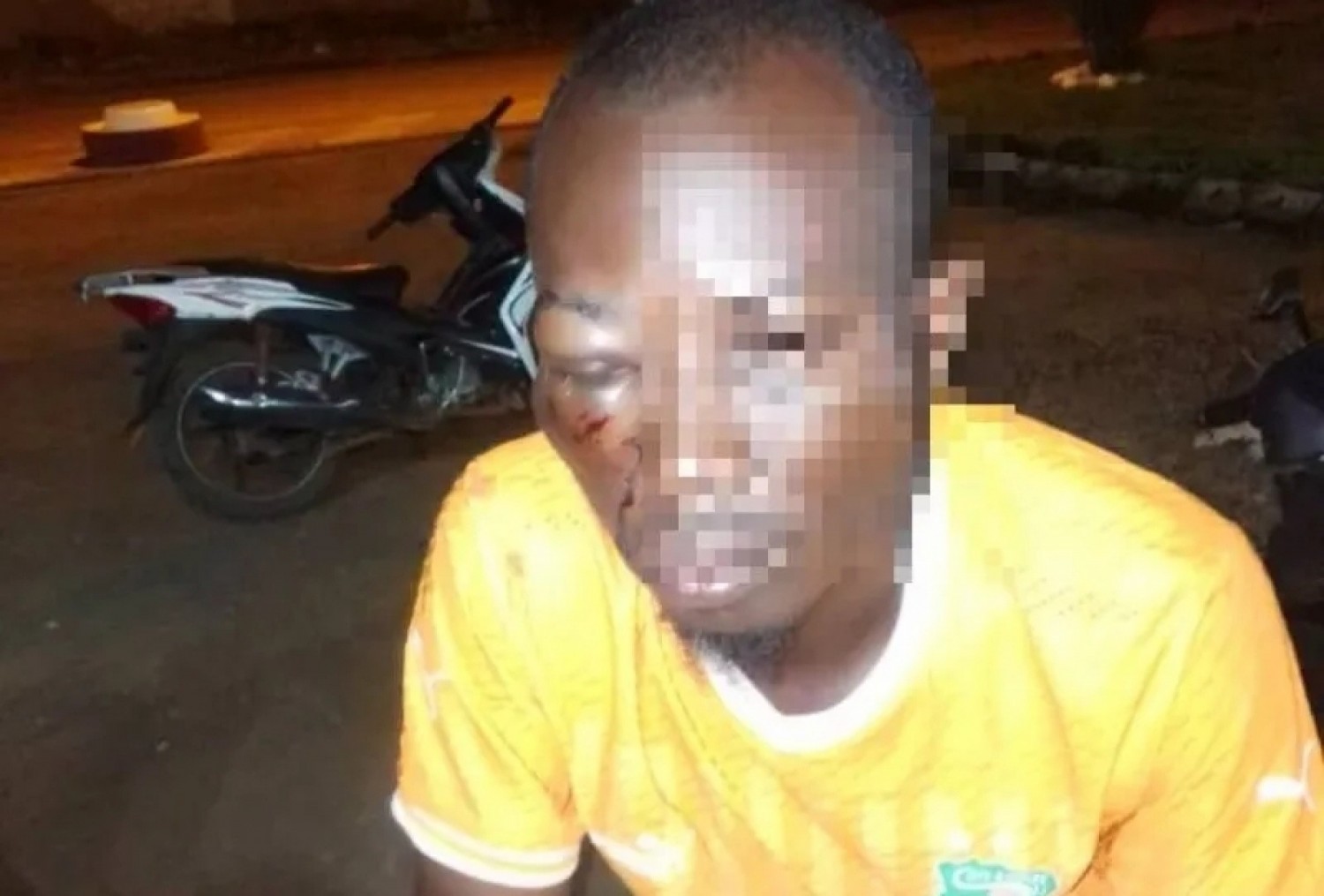 Côte d'Ivoire : Man, un anniversaire tourne au cauchemar dans un bar, des gendarmes impliqués, plusieurs blessés