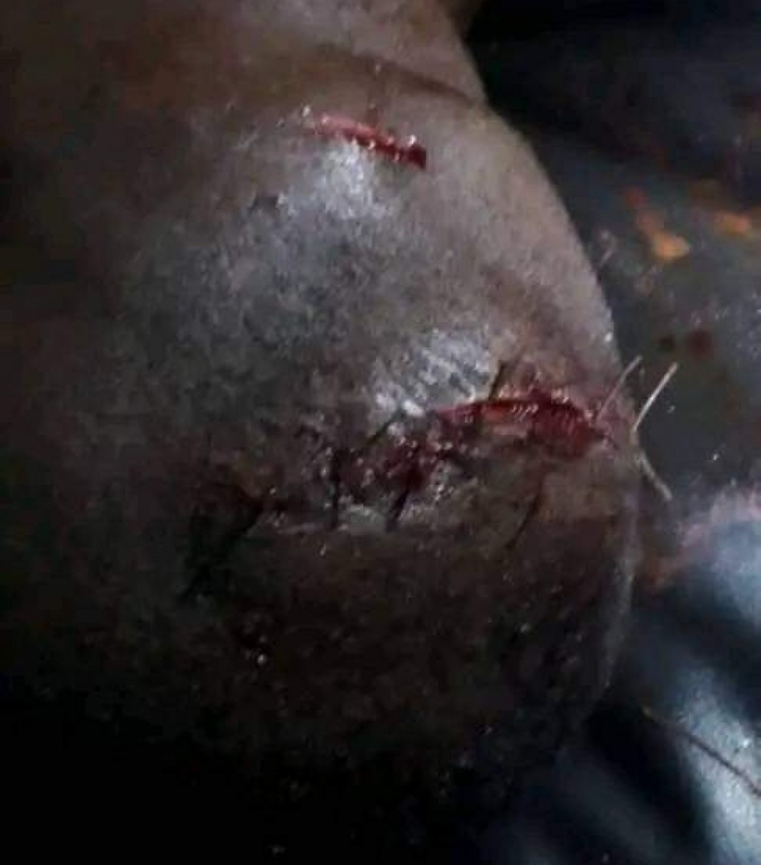 Côte d'Ivoire : Violences atroces à Gueyo, un instituteur tailladé à la machette