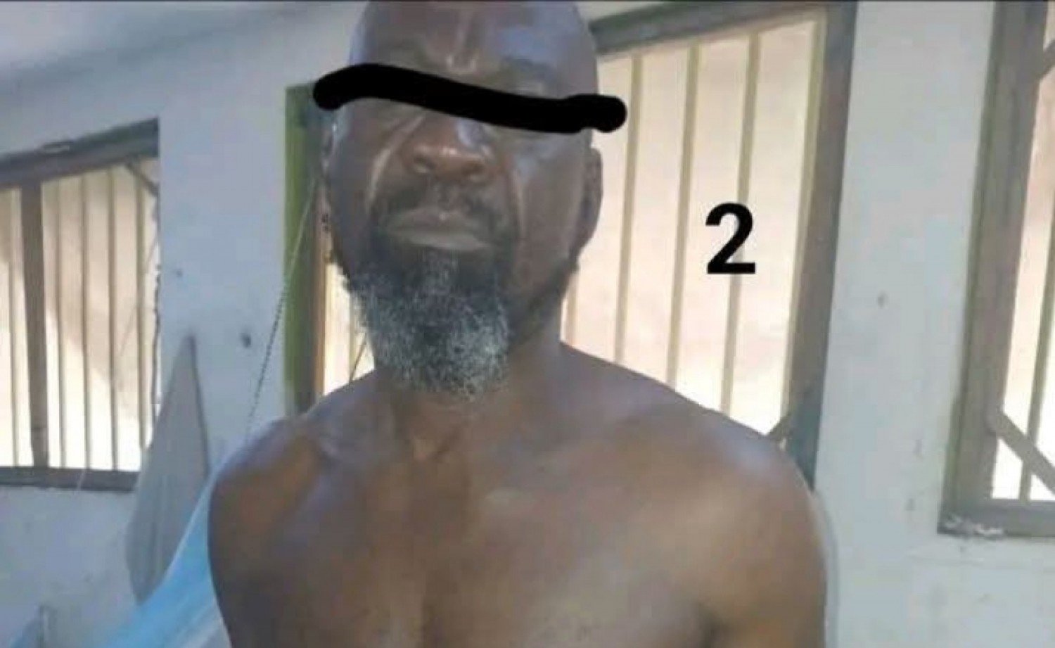 Côte d'Ivoire : Le détenu Koré Sery Évariste décède suite à une intervention chirurgicale