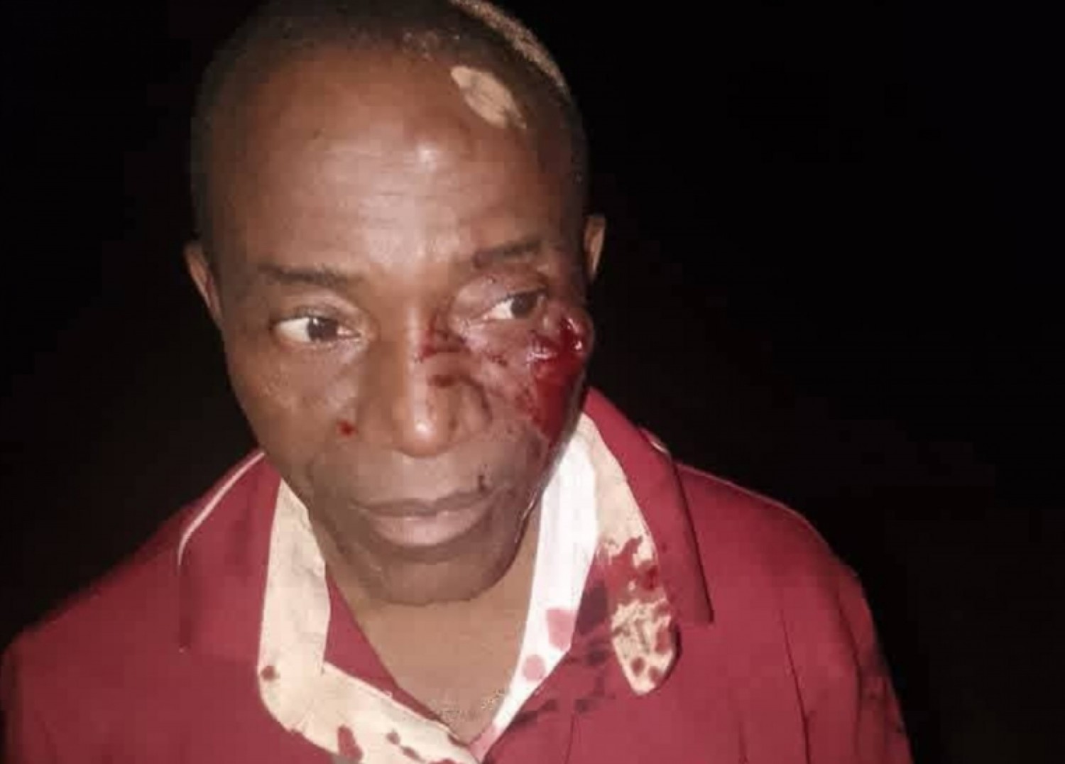 Côte d'Ivoire : Guiberoua, un directeur d'école violemment agressé, l'auteur présumé placé en garde à vue