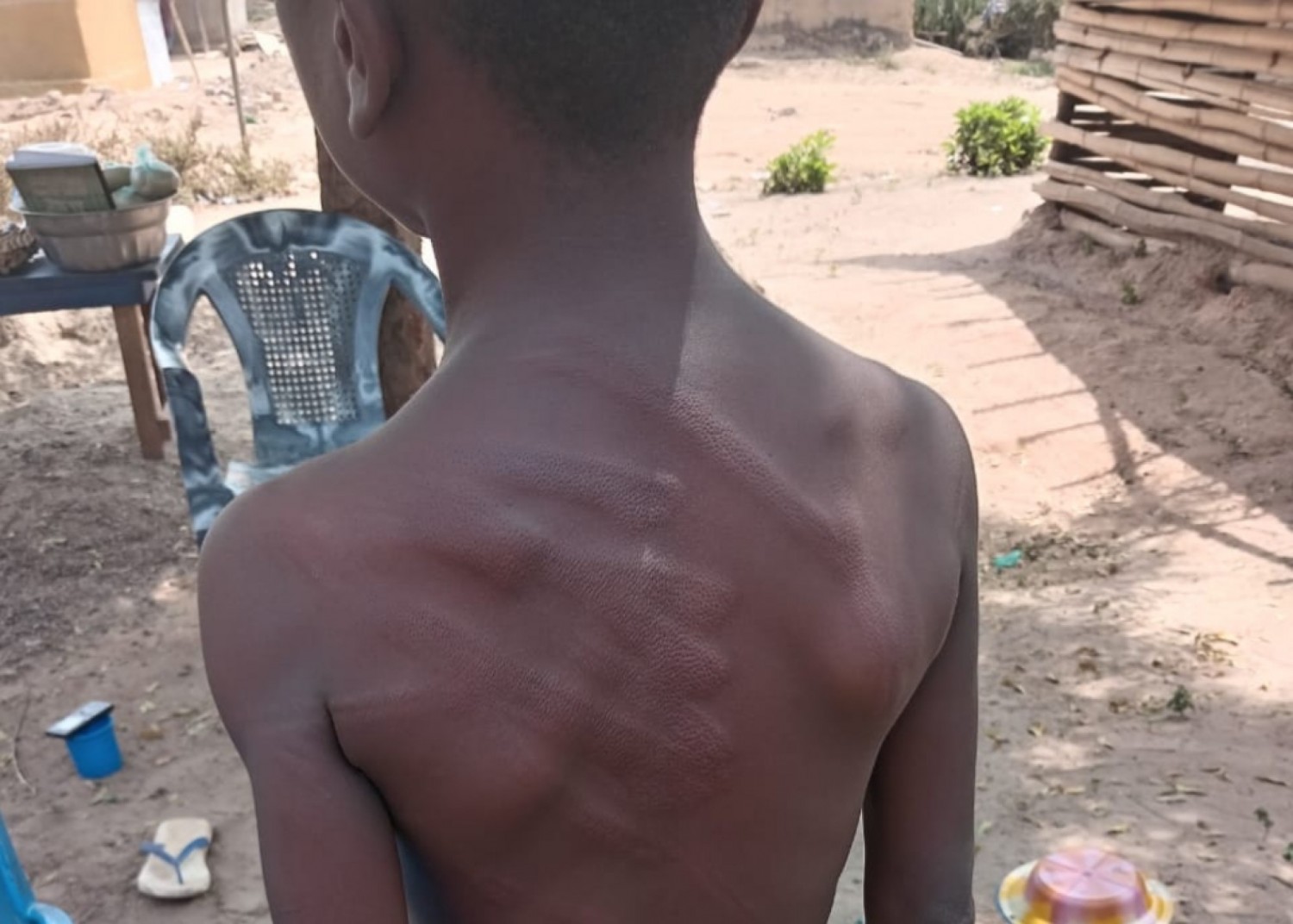 Côte d'Ivoire : Mahapleu sous tension après la punition d'un élève de 7 ans dans une école privée