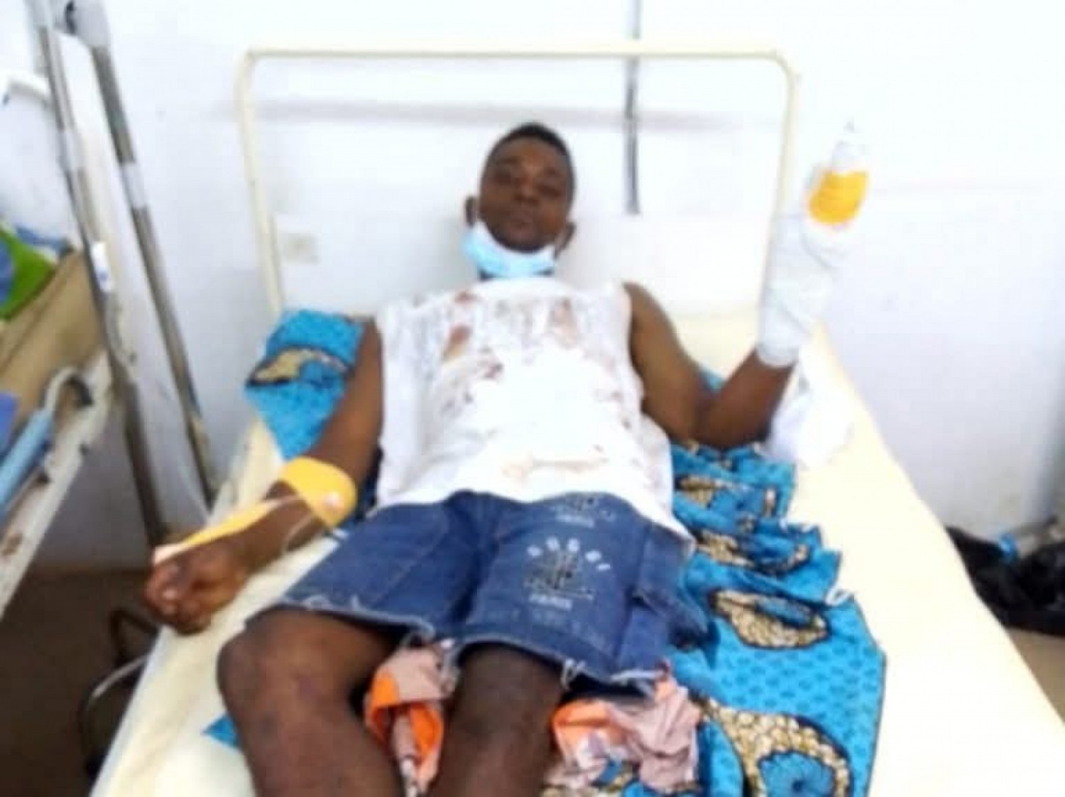 Côte d'Ivoire : Bocanda, un homme interpellé après une violente agression à la machette sur fond de rivalité