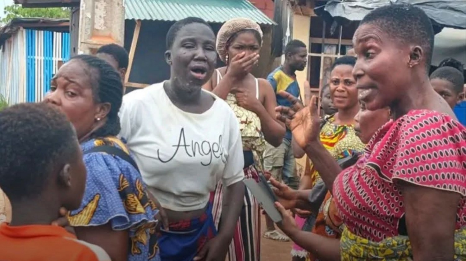 Côte d'Ivoire : À Afféry, une élève gravement blessée après une attaque à l'acide présumée par un moto-taximan
