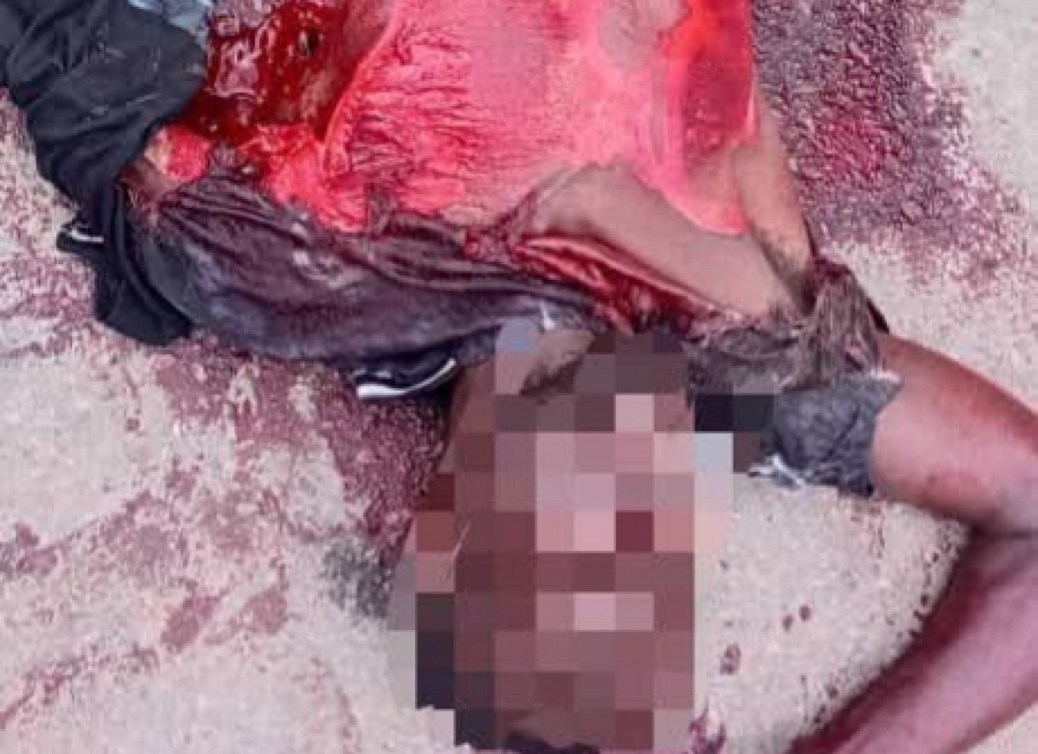 Côte d'Ivoire : Yopougon, un motocycliste blessé après une collision avec un camion