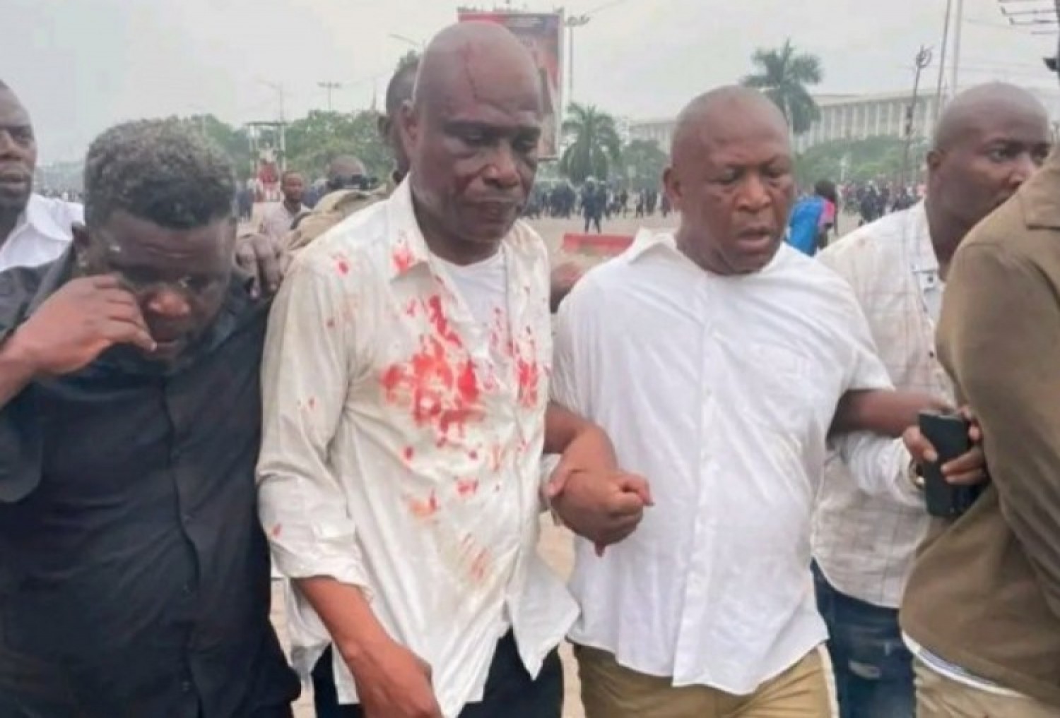 RDC : Des heurts éclatent à Kinshasa lors d'une manifestation, Martin Fayulu blessé