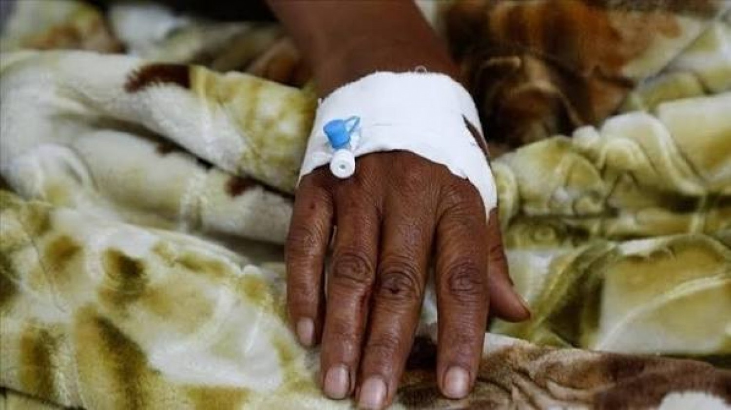 Centrafrique : Une épidémie de choléra déclarée, 197 cas recensés dont 24 décès