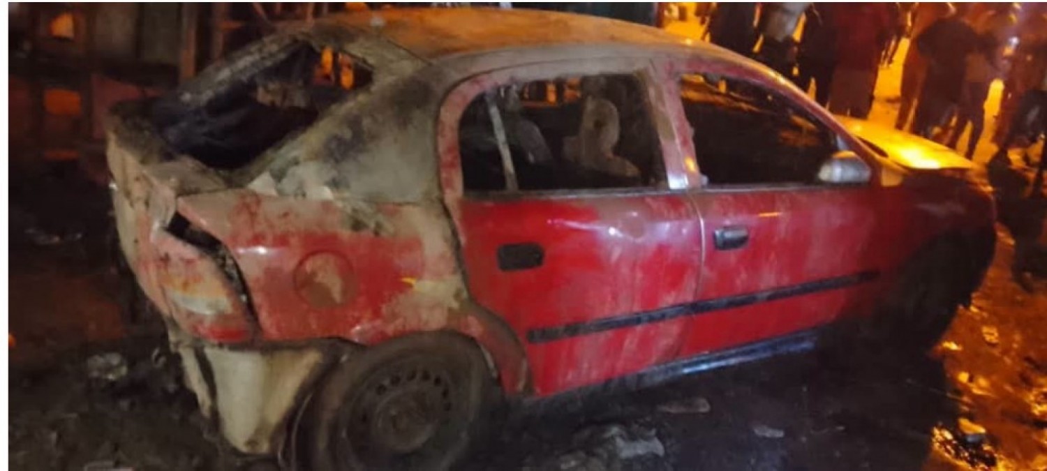 Côte d'Ivoire : Un appel téléphonique déclenche une explosion d'un véhicule, le conducteur gravement brûlé