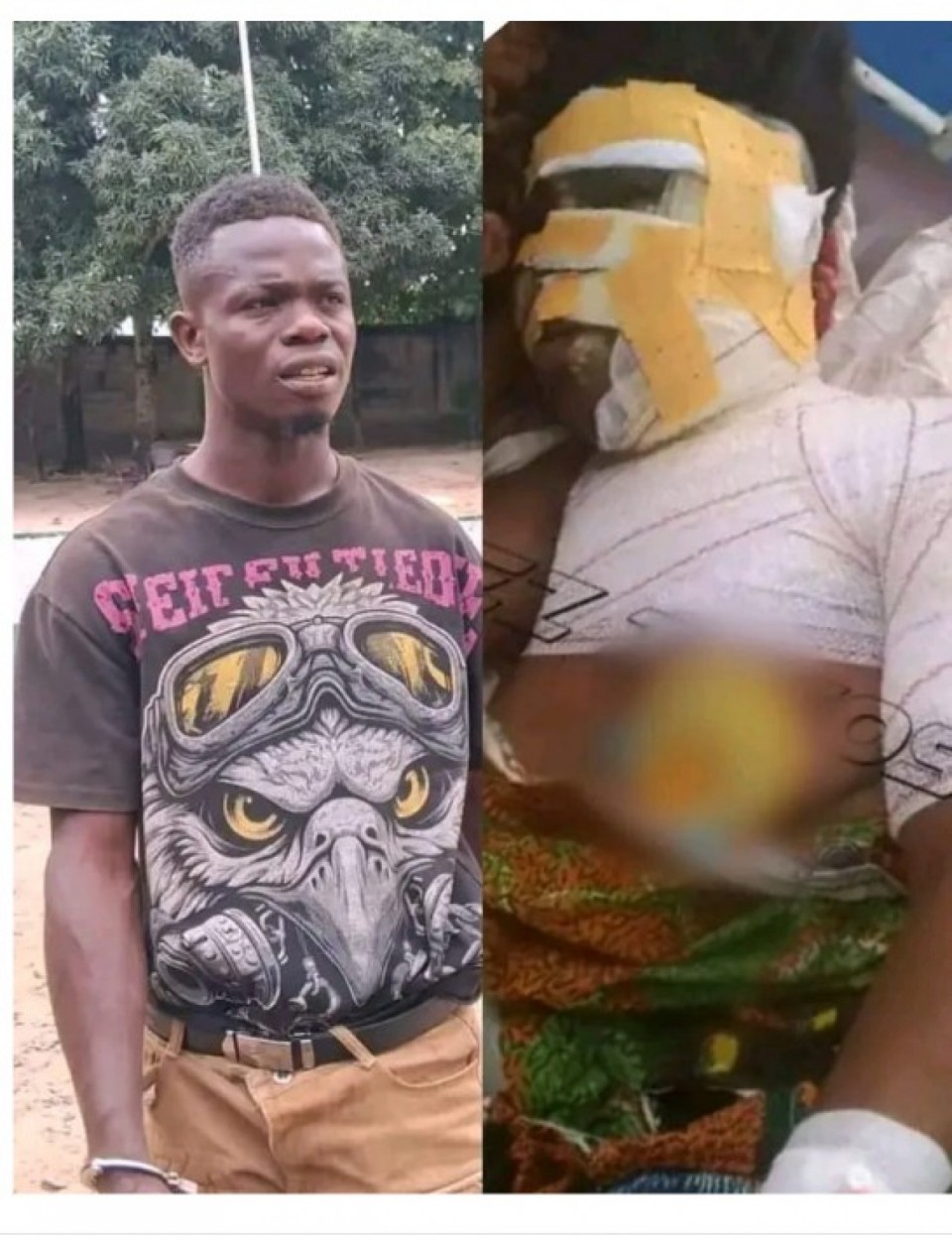 Côte d'Ivoire : Crise de jalousie à l'ouest ? Il asperge sa compagne de carburant  et met le feu