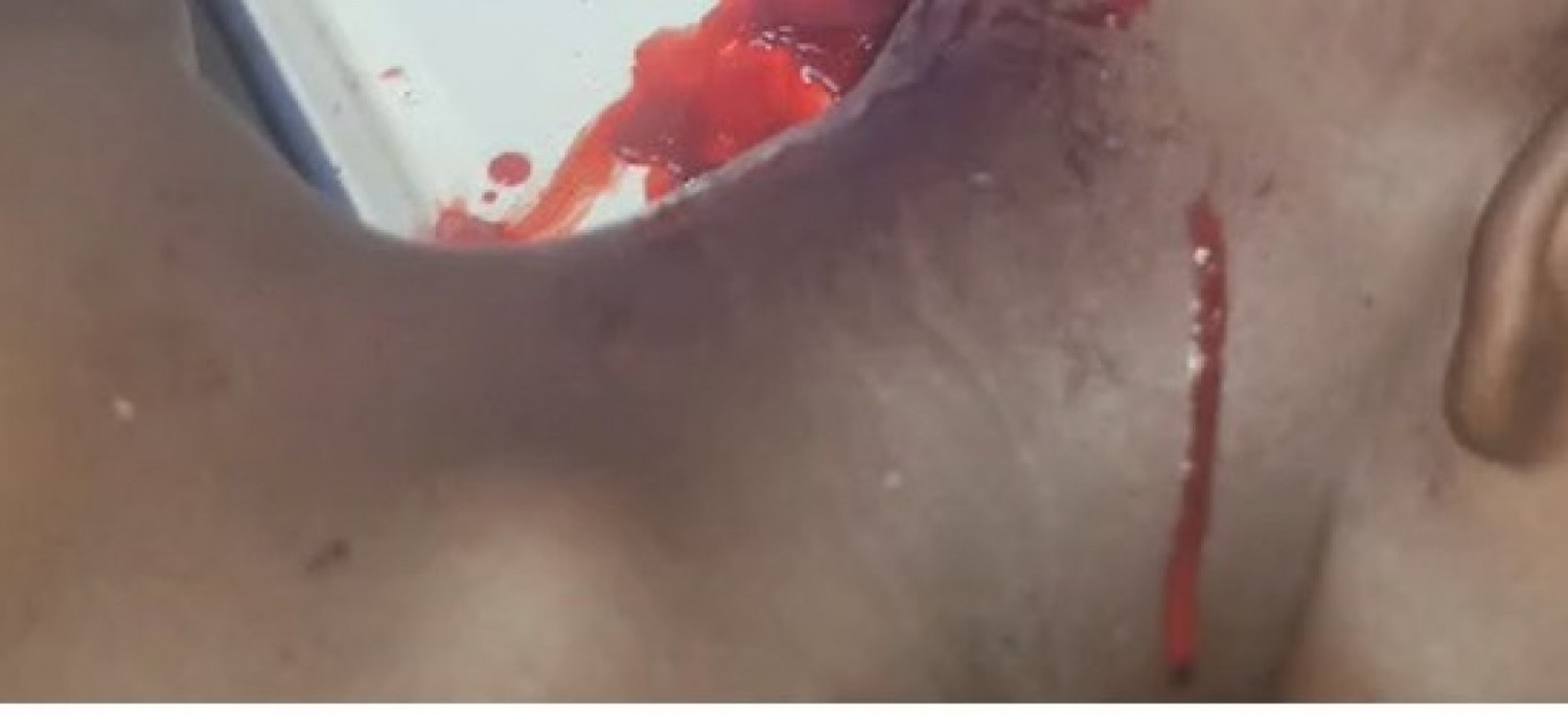Côte d'Ivoire : Bangolo, un buffle sème la peur au cœur du Mont Peko, une victime, plus de peur que de mal