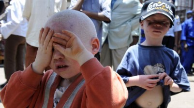 Burundi: Le corps d'un albinos de15 ans retrouvé démembré à la frontière avec la RDC