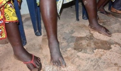 Côte d'Ivoire : La mystérieuse maladie qui sévit à Mankono non  encore été identifiée