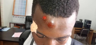 Côte d'Ivoire: À Cocody, un groupe d'élèves se réclamant de la Fesci molestent des enseignants, un élève blessé