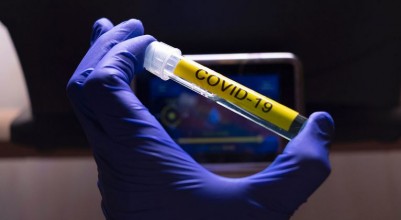 Coronavirus : Malgré une accélération de la pandémie, la trajectoire de Covid-19 peut être modifiée (OMS)