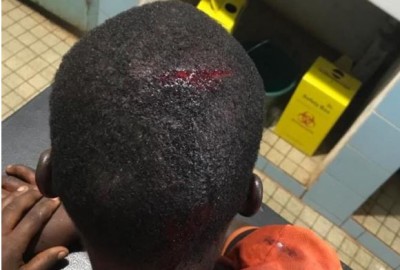 Côte d'Ivoire : A Daoukro, elle inflige  des sévices corporels à la fille de son mari pour ses visites récurrentes chez les voisins