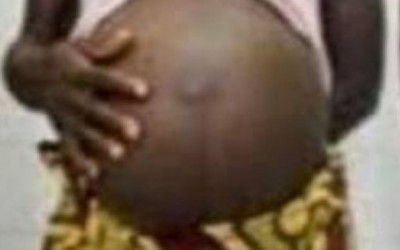 Burkina Faso : Un homme interpellé après avoir enceinté sa fille de 14 ans