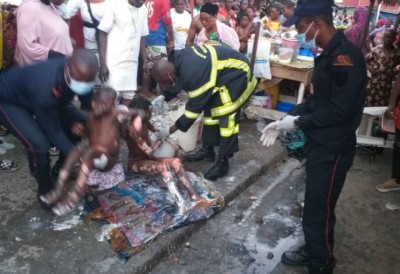 Côte d'Ivoire : Adjamé, des brûlés dans l'explosion d'une  bouteille lors d'une fête de réjouissance