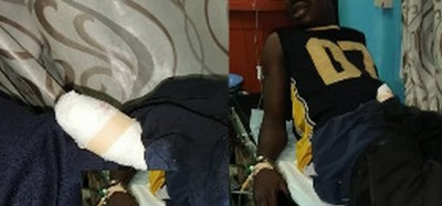 Ghana :  Un violeur mordu au pénis à Obuasi