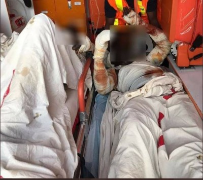 Côte d'Ivoire : Un  camion-citerne prend feu et fait deux victimes