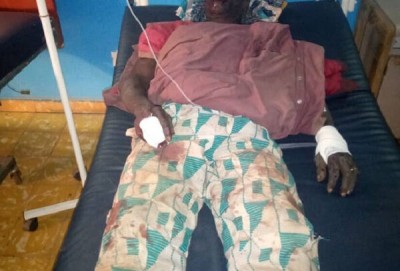 Côte d'Ivoire : Kani, un paysan ouvre le feu et blesse grièvement un bouvier à l'aide d'un fusil calibre 12