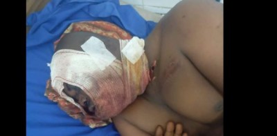 Côte d'Ivoire : Séguéla, un responsable FPI poignardé à la gorge par des individus non identifiés